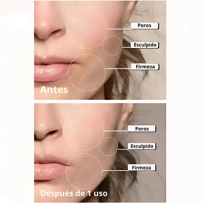 GLISSA® - Masajeador facial