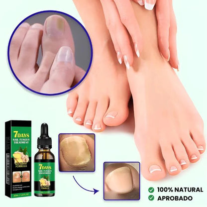PurNail® - Aceite antihongos uñas